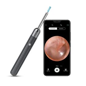 HD Camera Visual Ear Pick (Option: Black With 4 Ear Pick Sets)